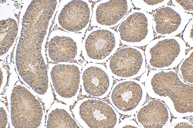 Prolactin Antibody in Immunohistochemistry (Paraffin) (IHC (P))