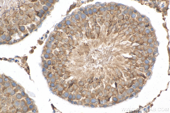 Prolactin Antibody in Immunohistochemistry (Paraffin) (IHC (P))