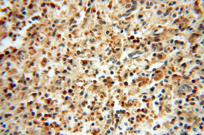 LARP4 Antibody in Immunohistochemistry (Paraffin) (IHC (P))