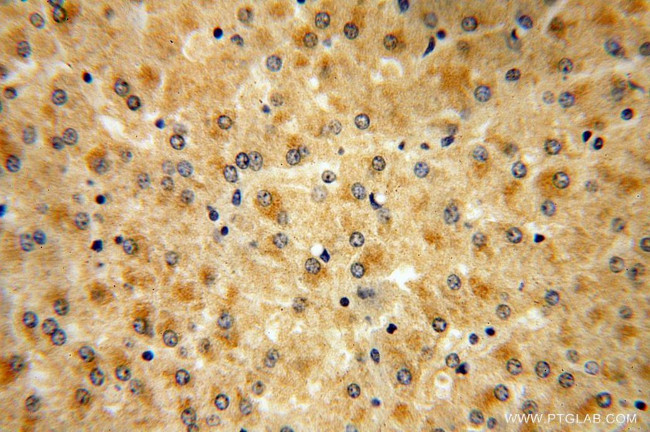 PALMD Antibody in Immunohistochemistry (Paraffin) (IHC (P))