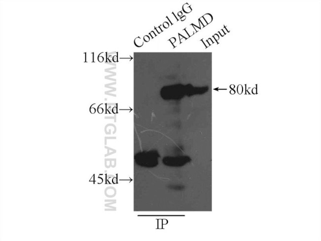 PALMD Antibody in Immunoprecipitation (IP)