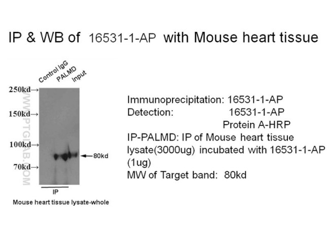 PALMD Antibody in Immunoprecipitation (IP)