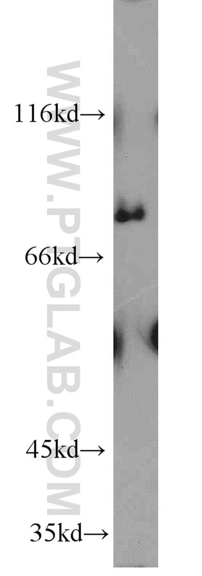 PALMD Antibody in Western Blot (WB)