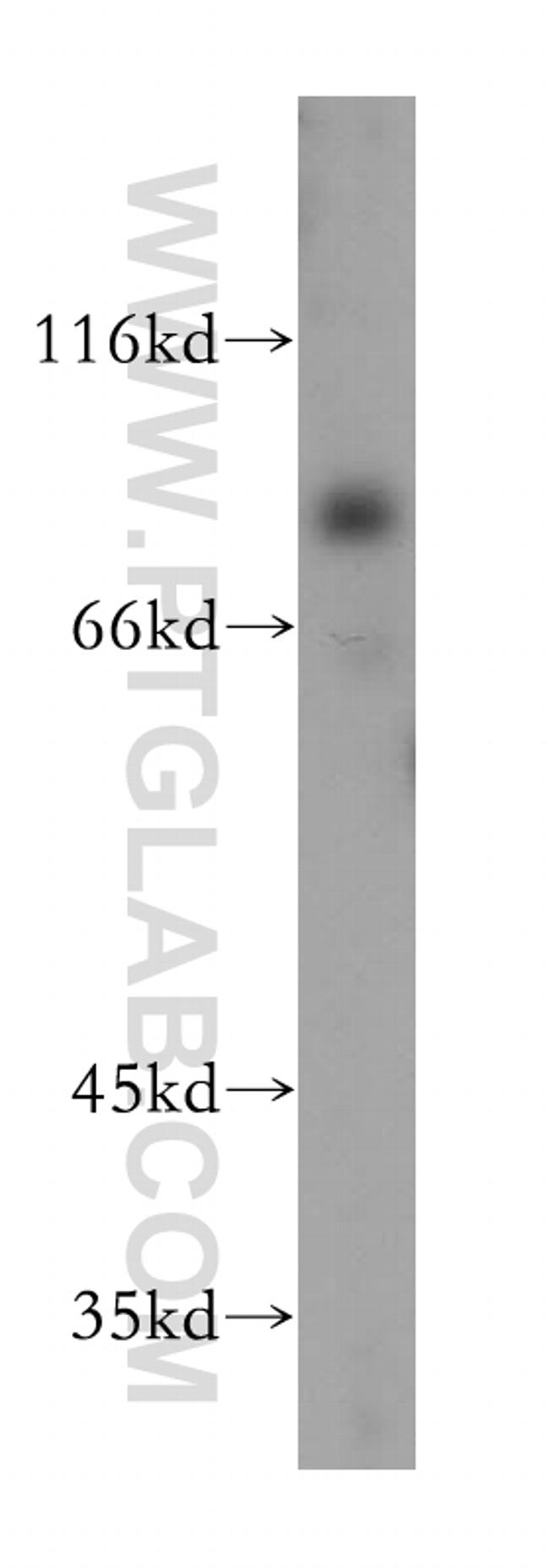 PALMD Antibody in Western Blot (WB)