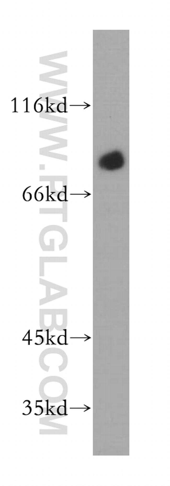 PALMD Antibody in Western Blot (WB)