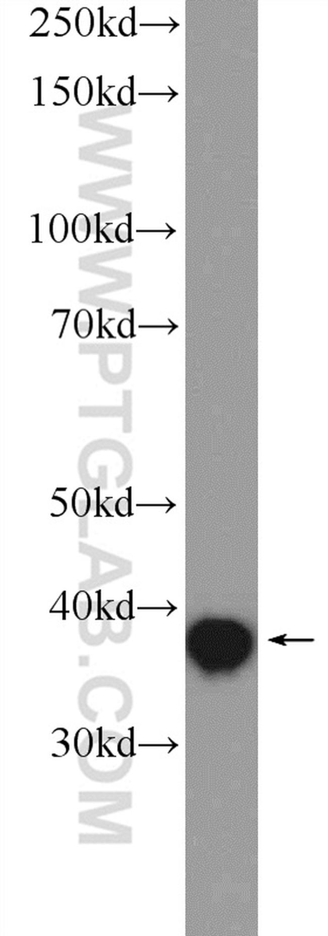 MRPS9 Antibody in Western Blot (WB)