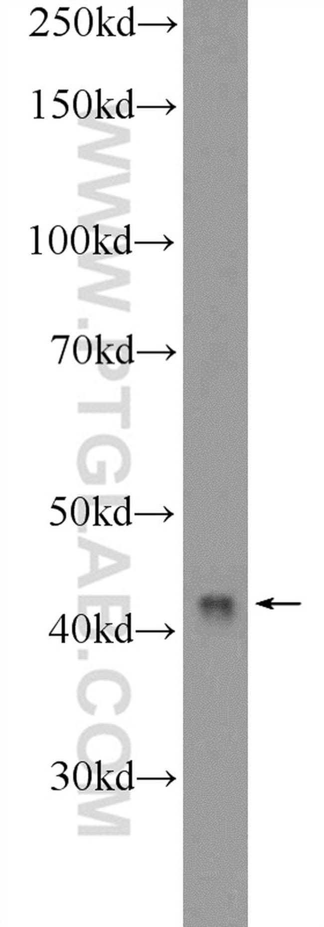 MRPS9 Antibody in Western Blot (WB)