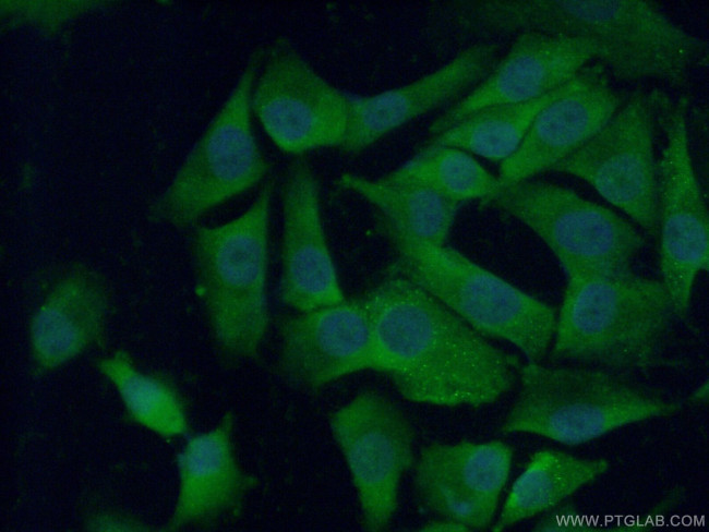 CTHRC1 Antibody in Immunocytochemistry (ICC/IF)