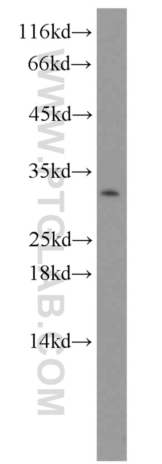 CTHRC1 Antibody in Western Blot (WB)