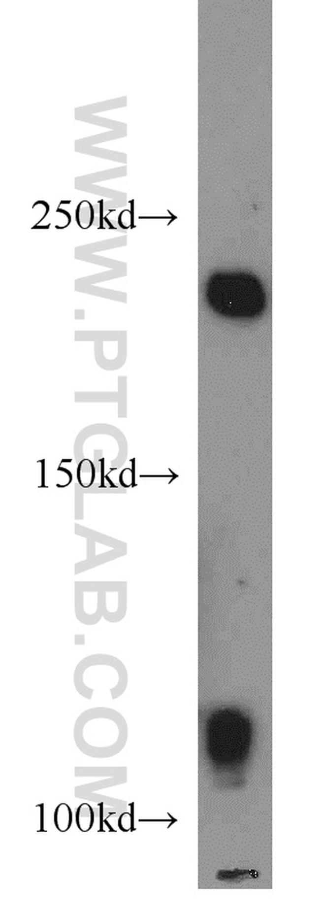 AXIN1 Antibody in Western Blot (WB)