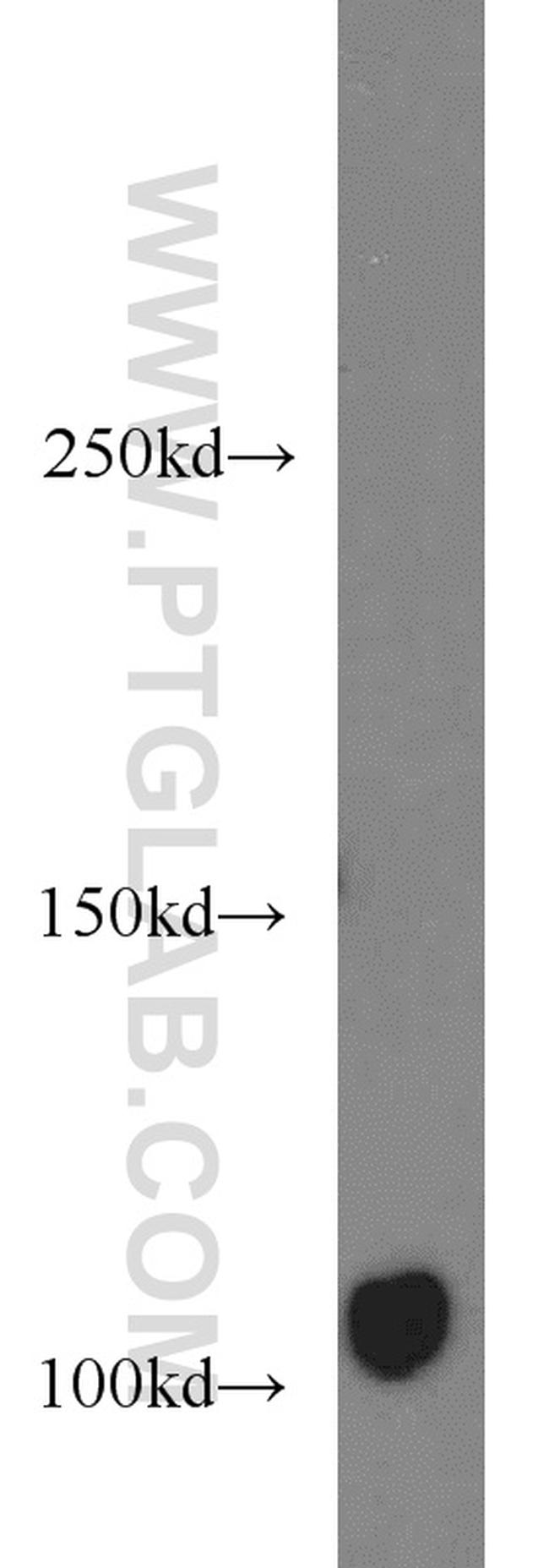 AXIN1 Antibody in Western Blot (WB)