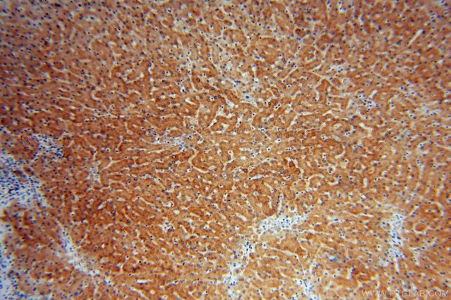 CYP2C8 Antibody in Immunohistochemistry (Paraffin) (IHC (P))