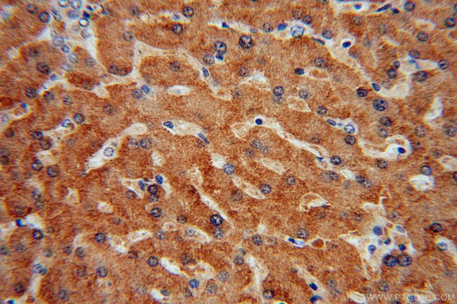 CYP2C8 Antibody in Immunohistochemistry (Paraffin) (IHC (P))