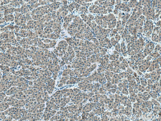 CYP2C8 Antibody in Immunohistochemistry (Paraffin) (IHC (P))