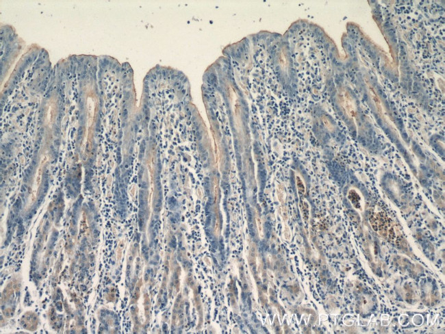 CCKAR Antibody in Immunohistochemistry (Paraffin) (IHC (P))