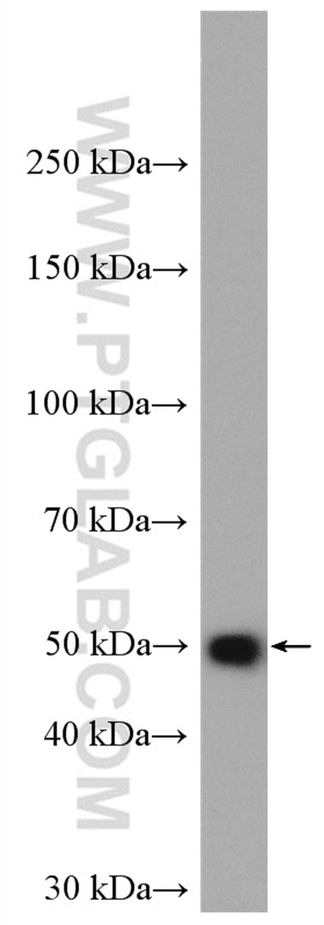 GLI4 Antibody in Western Blot (WB)