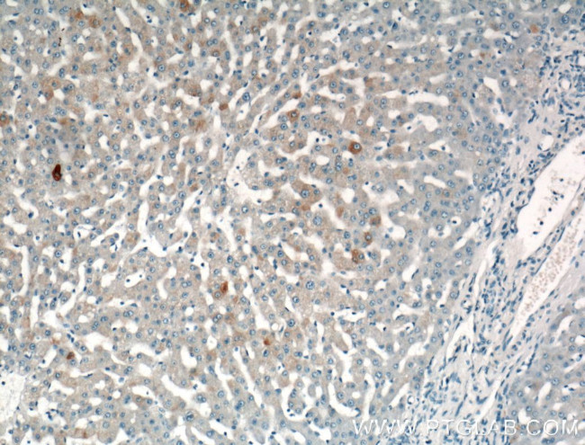 SPG11 Antibody in Immunohistochemistry (Paraffin) (IHC (P))