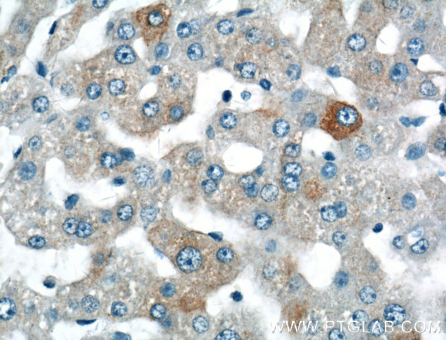 SPG11 Antibody in Immunohistochemistry (Paraffin) (IHC (P))