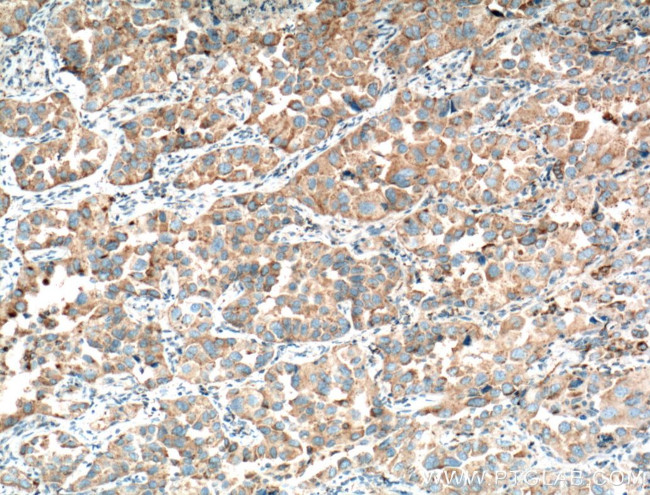 Napsin A Antibody in Immunohistochemistry (Paraffin) (IHC (P))