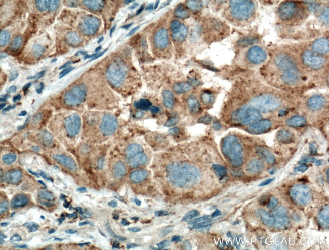 Napsin A Antibody in Immunohistochemistry (Paraffin) (IHC (P))