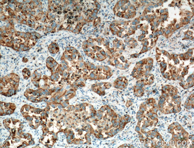 Napsin A Antibody in Immunohistochemistry (Paraffin) (IHC (P))