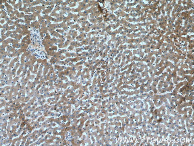 Fetuin-A Antibody in Immunohistochemistry (Paraffin) (IHC (P))