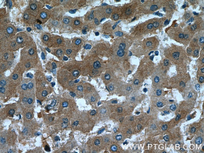 Fetuin-A Antibody in Immunohistochemistry (Paraffin) (IHC (P))