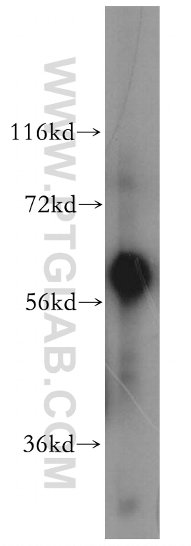 Fetuin-A Antibody in Western Blot (WB)