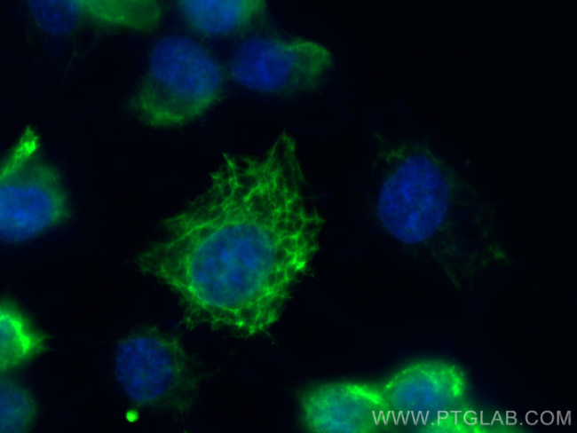 Cytokeratin 4 Antibody in Immunocytochemistry (ICC/IF)