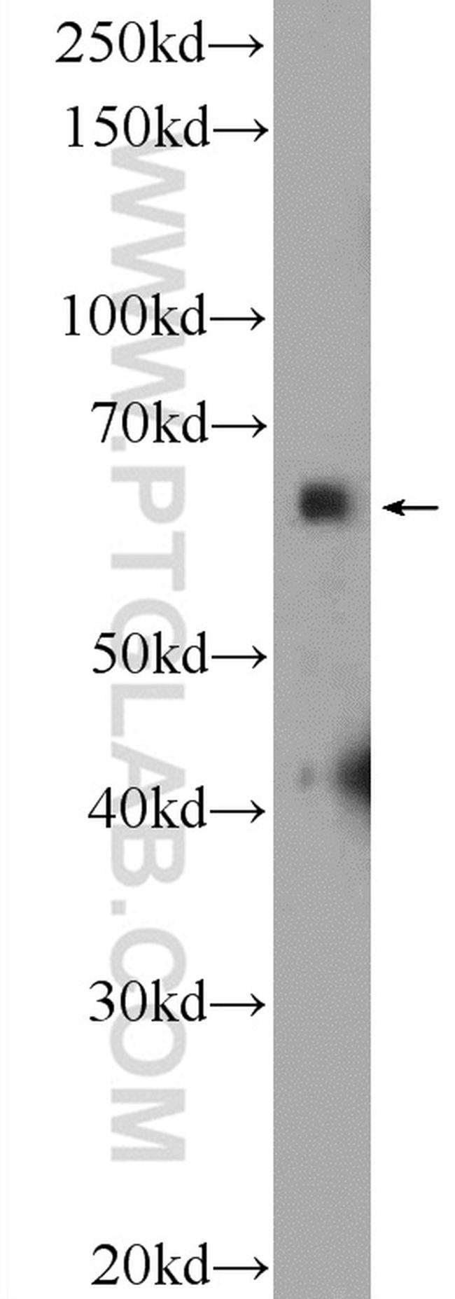 SYN2 Antibody in Western Blot (WB)