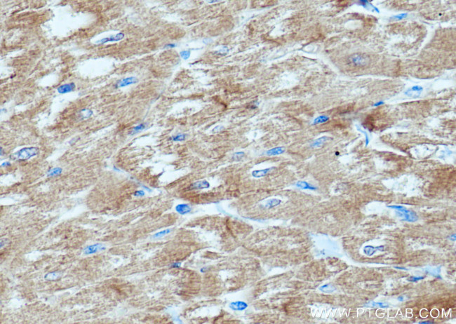 AGL Antibody in Immunohistochemistry (Paraffin) (IHC (P))