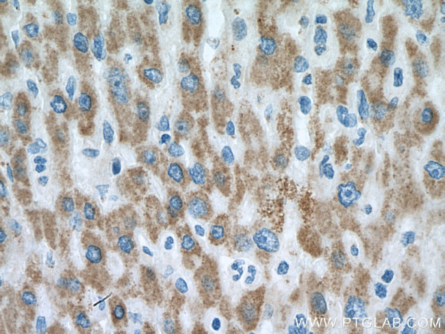 Pyruvate Carboxylase Antibody in Immunohistochemistry (Paraffin) (IHC (P))