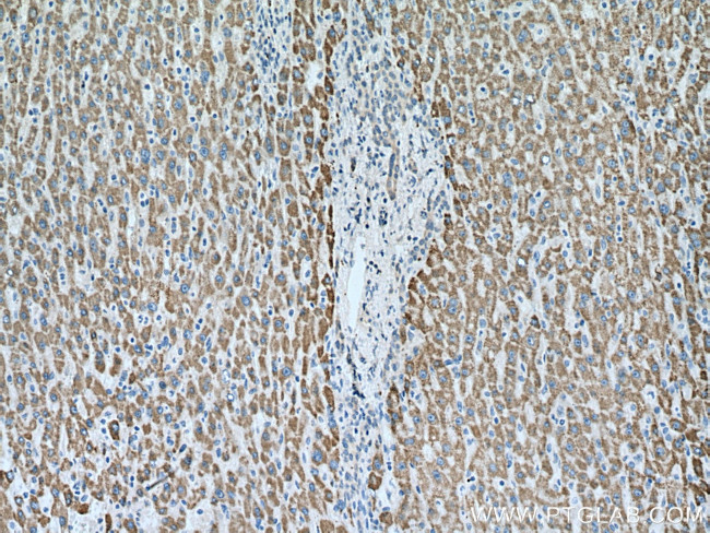 Pyruvate Carboxylase Antibody in Immunohistochemistry (Paraffin) (IHC (P))