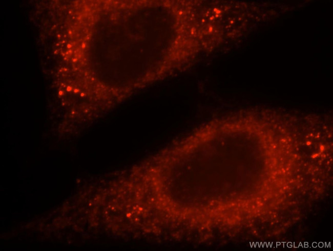 Pyruvate Carboxylase Antibody in Immunocytochemistry (ICC/IF)