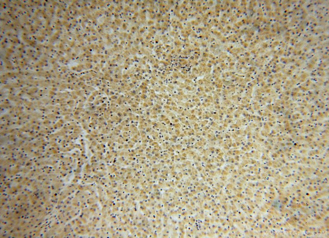 Pyruvate Carboxylase Antibody in Immunohistochemistry (Paraffin) (IHC (P))