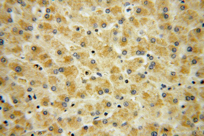 Pyruvate Carboxylase Antibody in Immunohistochemistry (Paraffin) (IHC (P))