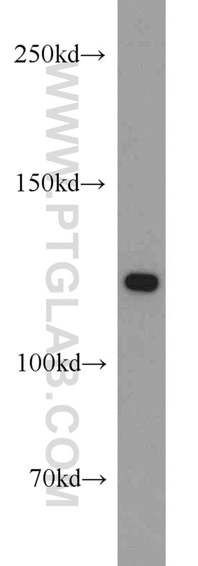 Pyruvate Carboxylase Antibody in Western Blot (WB)