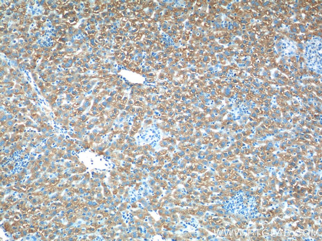 ACSM5 Antibody in Immunohistochemistry (Paraffin) (IHC (P))