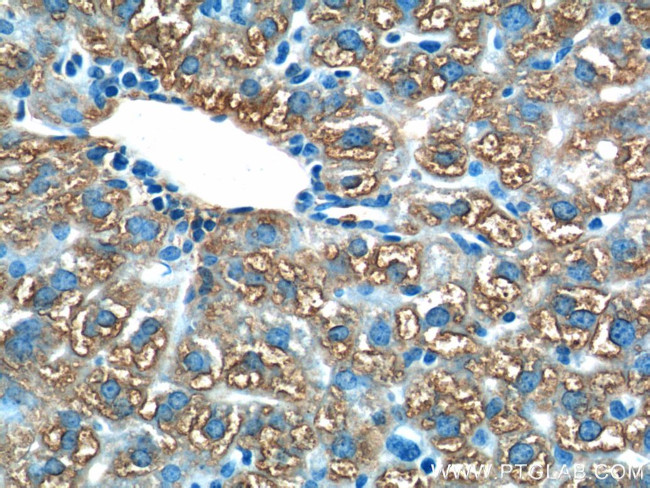 ACSM5 Antibody in Immunohistochemistry (Paraffin) (IHC (P))