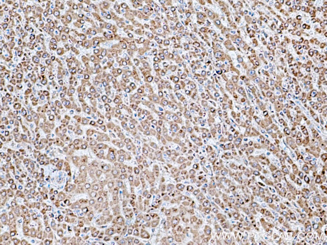 ACSM5 Antibody in Immunohistochemistry (Paraffin) (IHC (P))