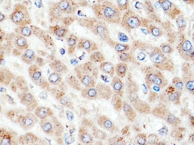 ACSM5 Antibody in Immunohistochemistry (Paraffin) (IHC (P))