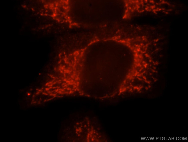 IMPA1 Antibody in Immunocytochemistry (ICC/IF)