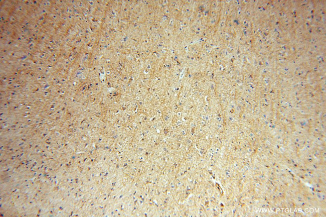 IMPA1 Antibody in Immunohistochemistry (Paraffin) (IHC (P))