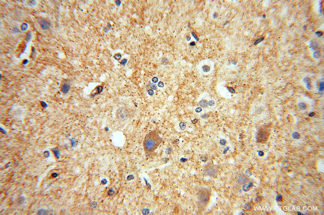 IMPA1 Antibody in Immunohistochemistry (Paraffin) (IHC (P))