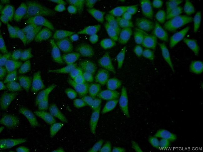 PGCP Antibody in Immunocytochemistry (ICC/IF)