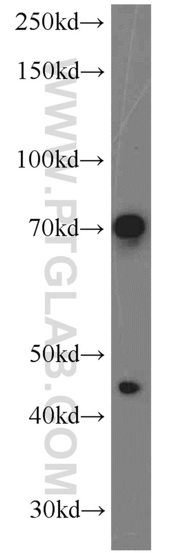 PGCP Antibody in Western Blot (WB)