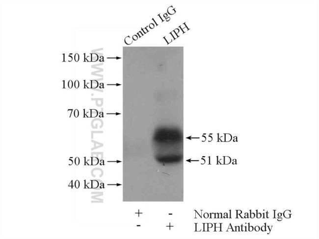 LIPH Antibody in Immunoprecipitation (IP)