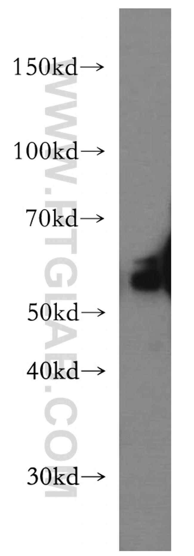 LIPH Antibody in Western Blot (WB)