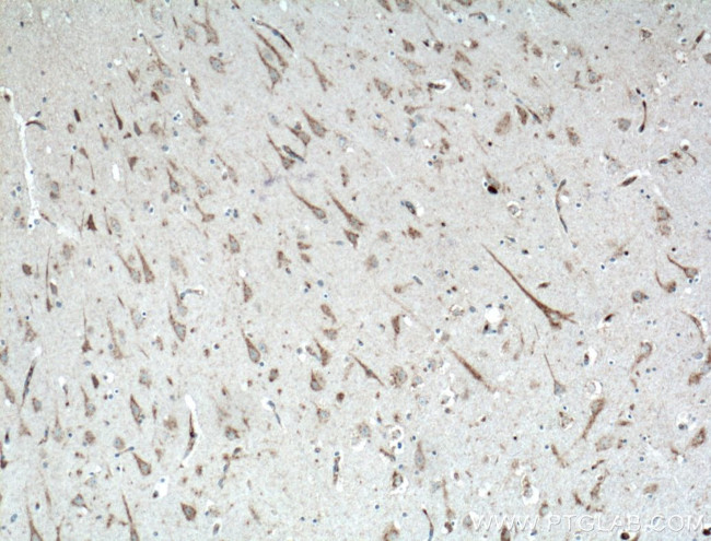 KCNMB2 Antibody in Immunohistochemistry (Paraffin) (IHC (P))