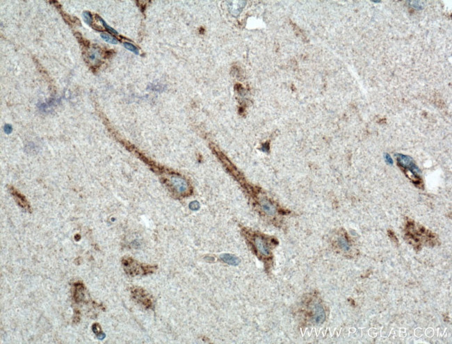 KCNMB2 Antibody in Immunohistochemistry (Paraffin) (IHC (P))